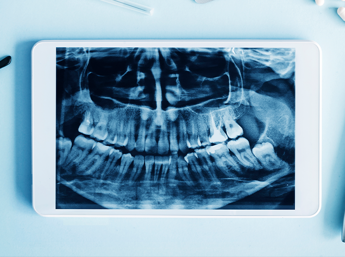Towson Cosmetic Dentist